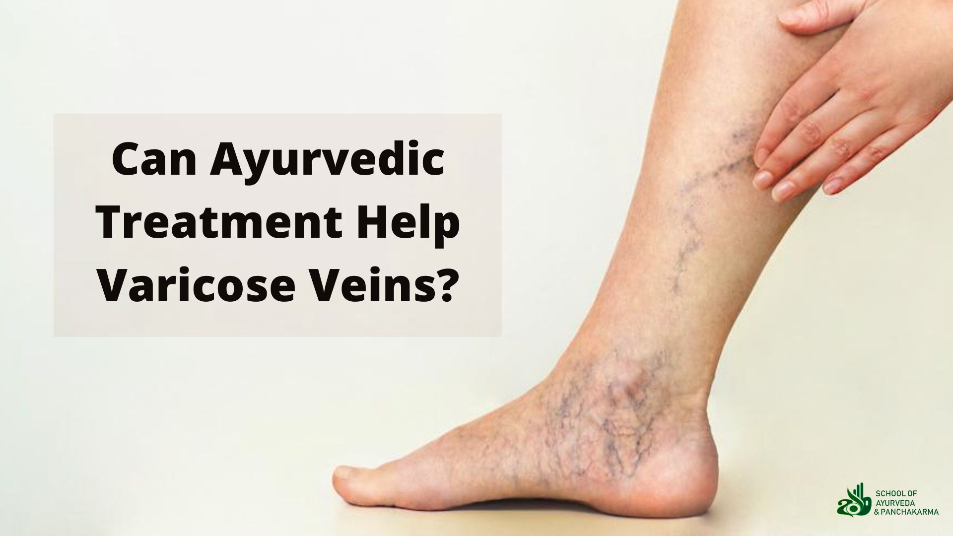 How to Treat Painful Varicose Veins at Home with Compression Stockings